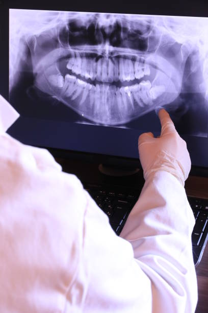 Best Emergency Treatment for Dental Infections or Abscesses in Massapequa, NY